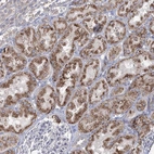 Immunohistochemical staining of human kidney shows moderate granular cytoplasmic positivity in cells in tubules.