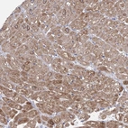 Immunohistochemical staining of human heart muscle shows moderate granular cytoplasmic positivity in cardiomyocytes.