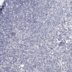 Immunohistochemical staining of human tonsil shows no positivity in non-germinal center cells as expected.