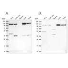 Western blot analysis using Anti-USO1 antibody HPA038283 (A) shows similar pattern to independent antibody HPA038282 (B).