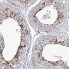 Immunohistochemical staining of human testis shows high expression.