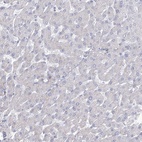 Immunohistochemical staining of human liver shows low expression as expected.