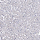 Immunohistochemical staining of human liver shows low expression as expected.