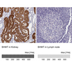 Anti-BHMT Antibody