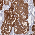 Immunohistochemical staining of human kidney shows strong cytoplasmic positivity in cells in tubules.