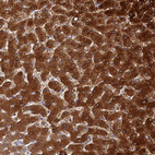 Anti-BHMT Antibody