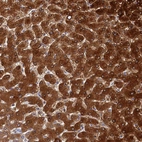 Immunohistochemical staining of human liver shows strong cytoplasmic positivity in hepatocytes.