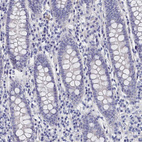 Anti-BHMT Antibody