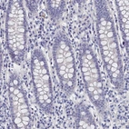 Immunohistochemical staining of human colon shows no positivity in glandular cells as expected.