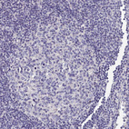 Immunohistochemical staining of human lymph node shows no positivity in germinal center cells as expected.