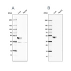 Western blot analysis using Anti-BHMT antibody HPA038285 (A) shows similar pattern to independent antibody HPA058310 (B).