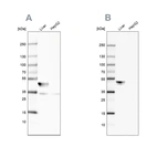 Western blot analysis using Anti-BHMT antibody HPA038285 (A) shows similar pattern to independent antibody HPA058310 (B).