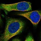 Immunofluorescent staining of human cell line U-2 OS shows localization to cytosol.
