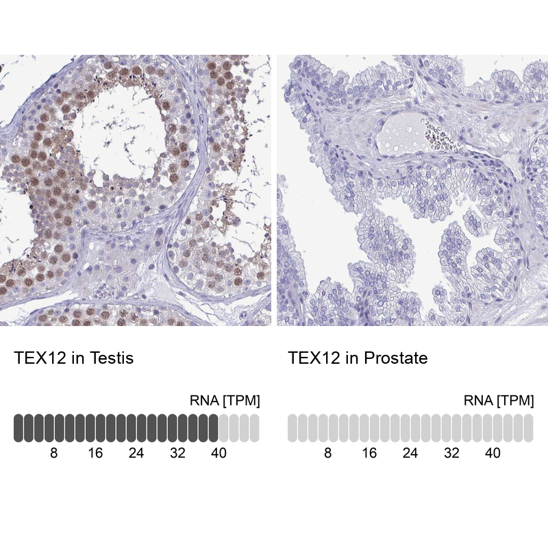 Anti-TEX12 Antibody