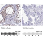 Anti-TEX12 Antibody