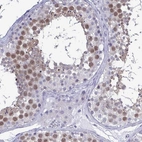 Immunohistochemical staining of human testis shows high expression.