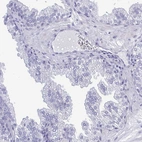 Immunohistochemical staining of human prostate shows low expression as expected.