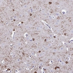 Immunohistochemical staining of human cerebral cortex shows strong cytoplasmic positivity in oligodendrocytes.