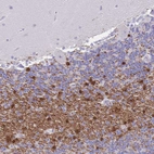 Immunohistochemical staining of human cerebellum shows strong positivity in oligodendrocytes.