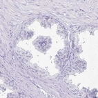 Immunohistochemical staining of human prostate shows no positivity in glandular cells as expected.