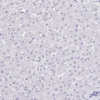 Immunohistochemical staining of human liver shows no positivity in hepatocytes as expected.