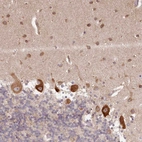 Immunohistochemical staining of human cerebellum shows strong cytoplasmic positivity in Purkinje cells.
