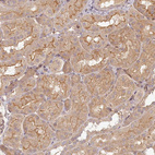 Immunohistochemical staining of human kidney shows moderate membranous and cytoplasmic positivity in cells in tubules.