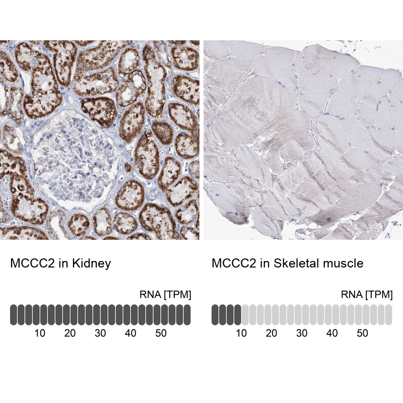 Anti-MCCC2 Antibody