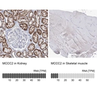 Anti-MCCC2 Antibody