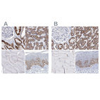 Immunohistochemical staining of human kidney, liver, skeletal muscle and skin using Anti-MCCC2 antibody HPA038301 (A) shows similar protein distribution across tissues to independent antibody HPA038300 (B).