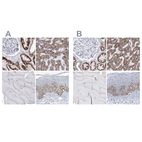 Immunohistochemical staining of human kidney, liver, skeletal muscle and skin using Anti-MCCC2 antibody HPA038301 (A) shows similar protein distribution across tissues to independent antibody HPA038300 (B).