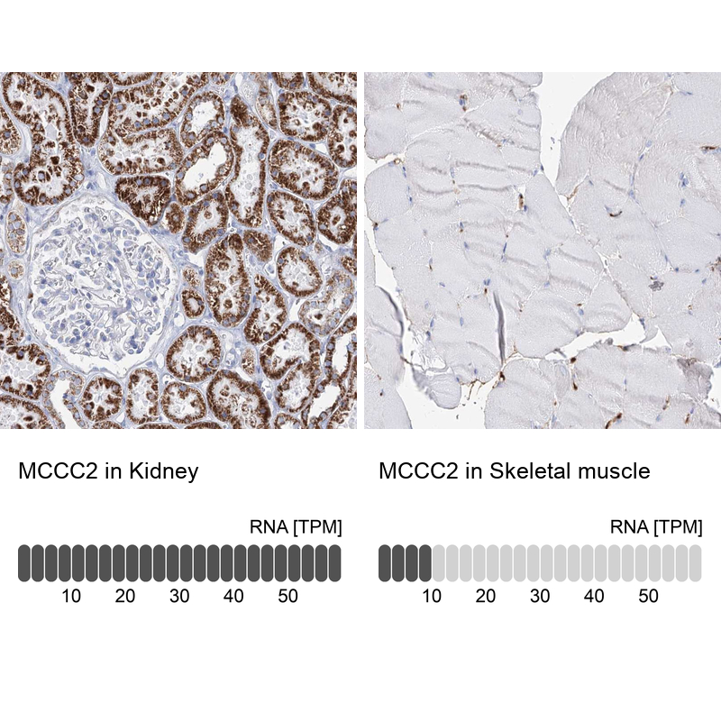 Anti-MCCC2 Antibody