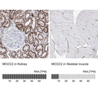 Anti-MCCC2 Antibody