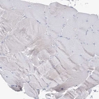 Immunohistochemical staining of human skeletal muscle shows low expression as expected.