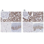 Immunohistochemical staining of human kidney, liver, skeletal muscle and skin using Anti-MCCC2 antibody HPA038300 (A) shows similar protein distribution across tissues to independent antibody HPA038301 (B).