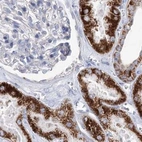 Immunohistochemical staining of human kidney using Anti-MCCC2 antibody HPA038301.