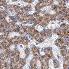 Immunohistochemical staining of human liver using Anti-MCCC2 antibody HPA038301.