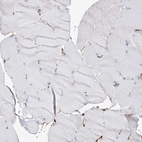 Immunohistochemical staining of human skeletal muscle shows low expression as expected.