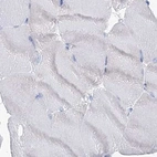 Immunohistochemical staining of human skeletal muscle using Anti-MCCC2 antibody HPA038301.
