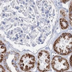 Immunohistochemical staining of human kidney using Anti-MCCC2 antibody HPA038300.