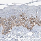 Immunohistochemical staining of human skin using Anti-MCCC2 antibody HPA038301.