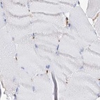 Immunohistochemical staining of human skeletal muscle using Anti-MCCC2 antibody HPA038300.