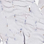 Immunohistochemical staining of human skeletal muscle using Anti-MCCC2 antibody HPA038300.