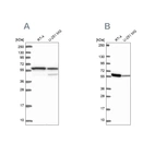Western blot analysis using Anti-MCCC2 antibody HPA038301 (A) shows similar pattern to independent antibody HPA061546 (B).