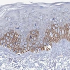Immunohistochemical staining of human skin using Anti-MCCC2 antibody HPA038300.