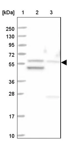 Lane 1: Marker [kDa] 250, 130, 95, 72, 55, 36, 28, 17, 10_br/_Lane 2: Human cell line RT-4_br/_Lane 3: Human cell line U-251 MG