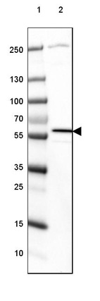 Lane 1: Marker [kDa] 250, 130, 100, 70, 55, 35, 25, 15, 10_br/_Lane 2: Human cell line RT-4