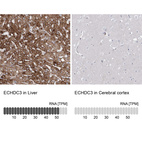 Anti-ECHDC3 Antibody