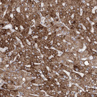 Immunohistochemical staining of human liver shows strong cytoplasm granular positivity in hepatocytes.