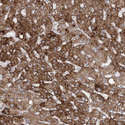 Anti-ECHDC3 Antibody